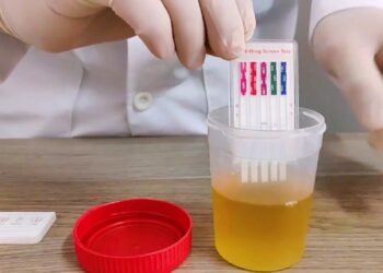 El antidoping viola los derechos de las y los trabajadores