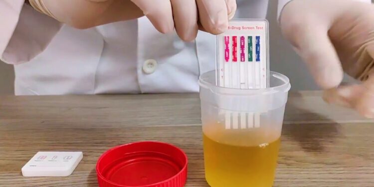 El antidoping viola los derechos de las y los trabajadores