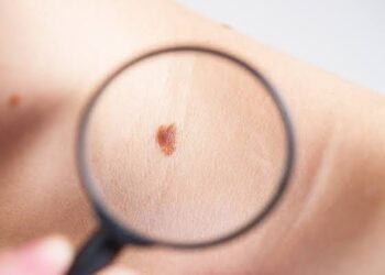 ALERTA SALUD COAHUILA SOBRE EFECTOS DE LOS RAYOS DEL SOL