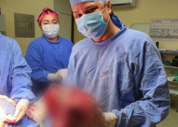 Extirpan especialistas de UMAE No. 14 del IMSS Veracruz Norte tumor maligno de 13 kilos