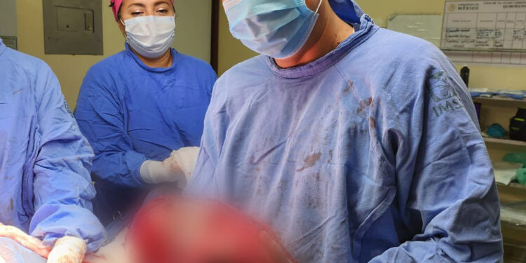 Extirpan especialistas de UMAE No. 14 del IMSS Veracruz Norte tumor maligno de 13 kilos