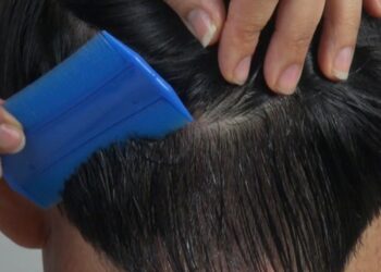 Recomiendan revisión constante a niñas y niños para prevenir propagación de pediculosis