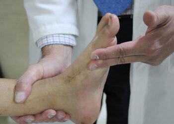 Hospital de Ortopedia del IMSS, a la vanguardia en atención de bebés con pie equinovaro