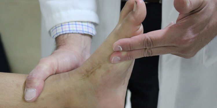 Hospital de Ortopedia del IMSS, a la vanguardia en atención de bebés con pie equinovaro