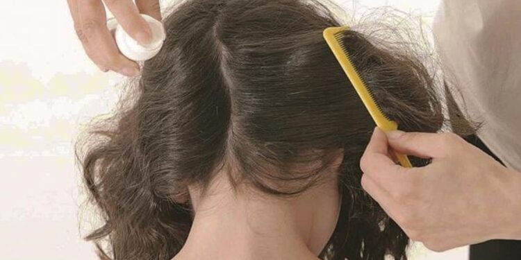 Alertan por proliferación de piojos en escuelas