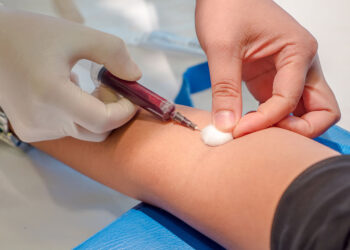 Se incrementan en laboratorios de PN pruebas de dengue; la mitad resultan positivas