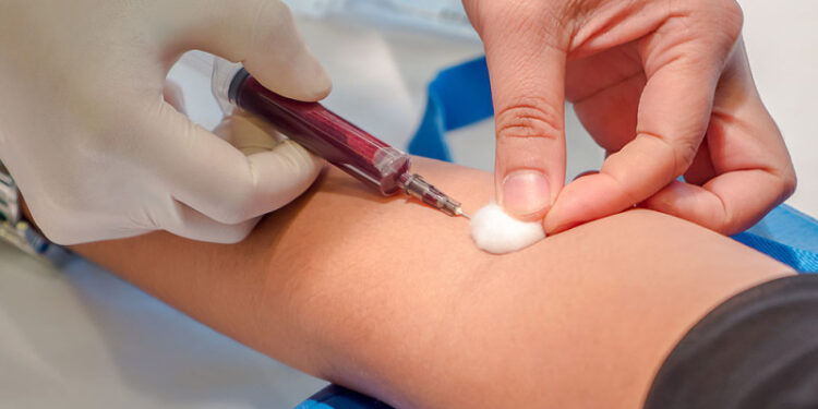 Se incrementan en laboratorios de PN pruebas de dengue; la mitad resultan positivas