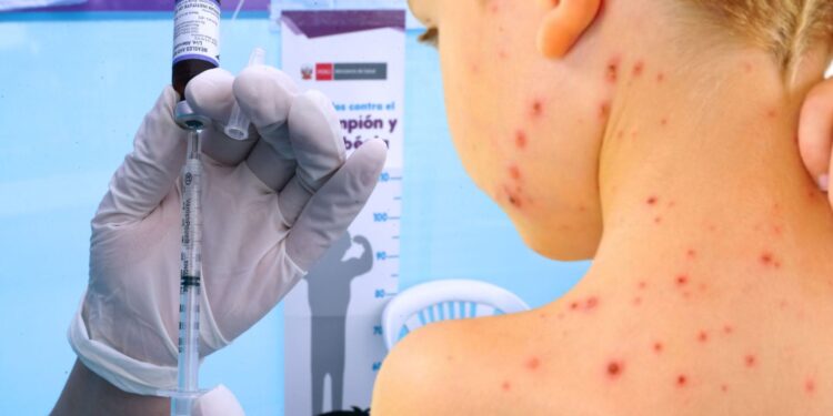 Salud insiste en completar esquemas de vacunación en menores