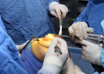 El IMSS atiende la artrosis degenerativa de rodilla con enfoque integral