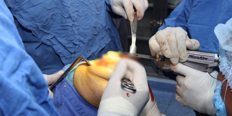 El IMSS atiende la artrosis degenerativa de rodilla con enfoque integral