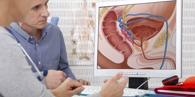 La detección temprana del cáncer de próstata mejora la posibilidad de recuperación: CE