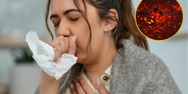 Detectan 125 casos de tuberculosis en Coahuila durante 2026